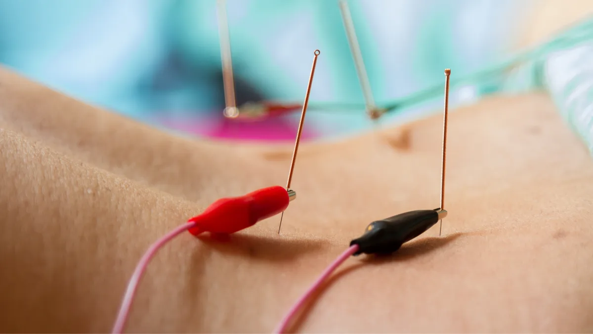Aplicación de electropuntura clínica con electrodos de precisión.